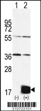 Western blot analysis of his-tag NRGN (arrow) using his tag antibody. 293 cell lysates (2 ug/lane) either nontransfected (Lane 1) or transiently transfected with the NRGN gene