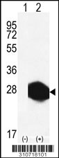 Western blot analysis of his-tag FTH1 (arrow) using his tag antibody. 293 cell lysates (2 ug/lane) either nontransfected (Lane 1) or transiently transfected with the FTH1 gene