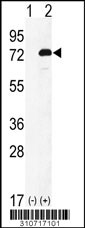 Western blot analysis of his-tag FBXO7 (arrow) using his tag antibody. 293 cell lysates (2 ug/lane) either nontransfected (Lane 1) or transiently transfected with the FBXO7 gene