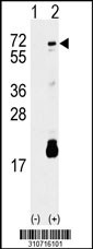Western blot analysis of his-tag FGFRL1 (arrow) using his tag antibody. 293 cell lysates (2 ug/lane) either nontransfected (Lane 1) or transiently transfected with the FGFRL1 gene