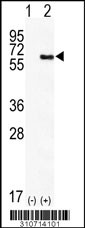Western blot analysis of his-tag CDC25A (arrow) using his tag antibody. 293 cell lysates (2 ug/lane) either nontransfected (Lane 1) or transiently transfected with the CDC25A gene