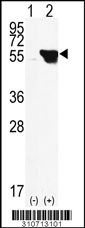 Western blot analysis of his-tag CAMK2B (arrow) using his tag antibody. 293 cell lysates (2 ug/lane) either nontransfected (Lane 1) or transiently transfected with the CAMK2B gene