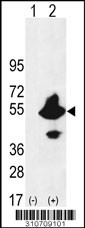 Western blot analysis of his-tag PRKACB (arrow) using his tag antibody. 293 cell lysates (2 ug/lane) either nontransfected (Lane 1) or transiently transfected with the PRKACB gene