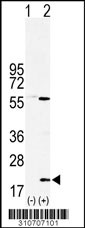 Western blot analysis of his-tag PMCH (arrow) using his tag antibody. 293 cell lysates (2 ug/lane) either nontransfected (Lane 1) or transiently transfected with the PMCH gene