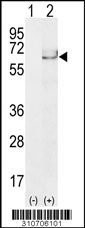 Western blot analysis of his-tag NR1H4 (arrow) using his tag antibody. 293 cell lysates (2 ug/lane) either nontransfected (Lane 1) or transiently transfected with the NR1H4 gene