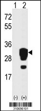 Western blot analysis of his-tag NQO2 (arrow) using his tag antibody. 293 cell lysates (2 ug/lane) either nontransfected (Lane 1) or transiently transfected with the NQO2 gene