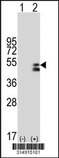 Western blot analysis of his-tag LMBR1 (arrow) using his tag antibody. 293T cell lysates (2 ug/lane) either nontransfected (Lane 1) or transiently transfected with the LMBR1 gene‘