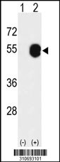 Western blot analysis of his-tag PDHA1 (arrow) using his tag antibody. 293 cell lysates (2 ug/lane) either nontransfected (Lane 1) or transiently transfected with the PDHA1 gene