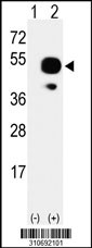 Western blot analysis of his-tag ATXN3 (arrow) using his tag antibody. 293 cell lysates (2 ug/lane) either nontransfected (Lane 1) or transiently transfected with the ATXN3 gene