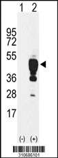 Western blot analysis of his-tag SERPINE1 (arrow) using his tag antibody. 293 cell lysates (2 ug/lane) either nontransfected (Lane 1) or transiently transfected with the SERPINE1 gene