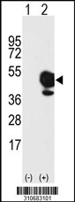 Western blot analysis of his-tag ILKAP (arrow) using his tag antibody. 293 cell lysates (2 ug/lane) either nontransfected (Lane 1) or transiently transfected with the ILKAP gene