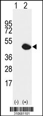 Western blot analysis of his-tag NME7 (arrow) using his tag antibody. 293 cell lysates (2 ug/lane) either nontransfected (Lane 1) or transiently transfected with the NME7 gene