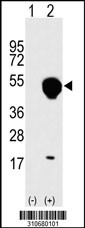 Western blot analysis of his-tag GLUL (arrow) using his tag antibody. 293 cell lysates (2 ug/lane) either nontransfected (Lane 1) or transiently transfected with the GLUL gene