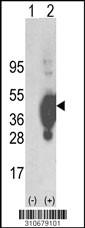 Western blot analysis of his-tag CDK9 (arrow) using his tag antibody. 293 cell lysates (2 ug/lane) either nontransfected (Lane 1) or transiently transfected with the CDK9 gene (Lane 2, Cat. #LY10679a).