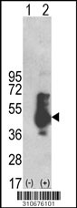 Western blot analysis of his-tag FCAR (arrow) using his tag antibody. 293 cell lysates (2 ug/lane) either nontransfected (Lane 1) or transiently transfected with the FCAR gene (Lane 2, Cat. #LY10676a).