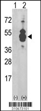 Western blot analysis of his-tag PSKH1 (arrow) using his tag antibody. 293 cell lysates (2 ug/lane) either nontransfected (Lane 1) or transiently transfected with the PSKH1 gene (Lane 2, Cat. #LY10673a).
