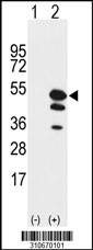 Western blot analysis of his-tag CAMK1G (arrow) using his tag antibody. 293 cell lysates (2 ug/lane) either nontransfected (Lane 1) or transiently transfected with the CAMK1G gene