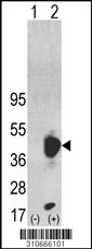 Western blot analysis of his-tag PRPSAP2 (arrow) using his tag antibody. 293 cell lysates (2 ug/lane) either nontransfected (Lane 1) or transiently transfected with the PRPSAP2 gene (Lane 2, Cat. #LY10666a).