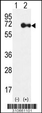Western blot analysis of his-tag ACVRL1 (arrow) using his tag antibody. 293 cell lysates (2 ug/lane) either nontransfected (Lane 1) or transiently transfected with the ACVRL1 gene