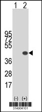 Western blot analysis of his-tag PAQR8 (arrow) using his tag antibody. 293T cell lysates (2 ug/lane) either nontransfected (Lane 1) or transiently transfected with the PAQR8 gene‘