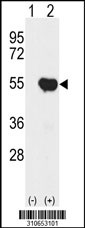 Western blot analysis of his-tag CAMK4 (arrow) using his tag antibody. 293 cell lysates (2 ug/lane) either nontransfected (Lane 1) or transiently transfected with the CAMK4 gene