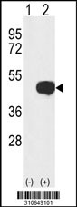 Western blot analysis of his-tag SPHK1 (arrow) using his tag antibody. 293 cell lysates (2 ug/lane) either nontransfected (Lane 1) or transiently transfected with the SPHK1 gene