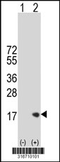Western blot analysis of his-tag LY6G6D (arrow) using his tag antibody. 293T cell lysates (2 ug/lane) either nontransfected (Lane 1) or transiently transfected with the LY6G6D gene‘