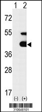 Western blot analysis of his-tag TRIB3 (arrow) using his tag antibody. 293 cell lysates (2 ug/lane) either nontransfected (Lane 1) or transiently transfected with the TRIB3 gene