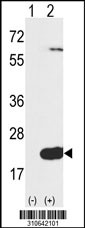 Western blot analysis of his-tag TPD52L3 (arrow) using his tag antibody. 293 cell lysates (2 ug/lane) either nontransfected (Lane 1) or transiently transfected with the TPD52L3 gene