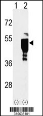 Western blot analysis of his-tag ITPK1 (arrow) using his tag antibody. 293 cell lysates (2 ug/lane) either nontransfected (Lane 1) or transiently transfected with the ITPK1 gene