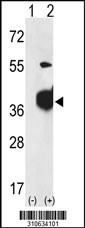 Western blot analysis of his-tag PRPS2 (arrow) using his tag antibody. 293 cell lysates (2 ug/lane) either nontransfected (Lane 1) or transiently transfected with the PRPS2 gene