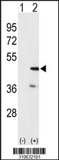 Western blot analysis of his-tag ETNK2 (arrow) using his tag antibody. 293 cell lysates (2 ug/lane) either nontransfected (Lane 1) or transiently transfected with the ETNK2 gene