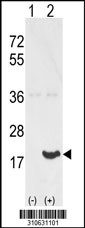 Western blot analysis of his-tag CDKN2B (arrow) using his tag antibody. 293 cell lysates (2 ug/lane) either nontransfected (Lane 1) or transiently transfected with the CDKN2B gene