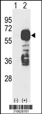 Western blot analysis of his-tag RARA (arrow) using his tag antibody. 293 cell lysates (2 ug/lane) either nontransfected (Lane 1) or transiently transfected with the RARA gene