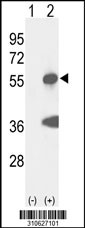 Western blot analysis of his-tag ESRRA (arrow) using his tag antibody. 293 cell lysates (2 ug/lane) either nontransfected (Lane 1) or transiently transfected with the ESRRA gene