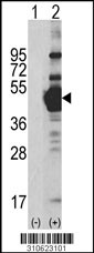 Western blot analysis of his-tag MAP2K1 (arrow) using his tag antibody. 293 cell lysates (2 ug/lane) either nontransfected (Lane 1) or transiently transfected with the MAP2K1 gene (Lane 2, Cat. #LY10623a).