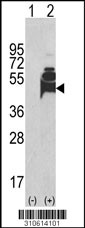 Western blot analysis of his-tag PIP4K2A (arrow) using his tag antibody. 293 cell lysates (2 ug/lane) either nontransfected (Lane 1) or transiently transfected with the PIP4K2A gene (Lane 2, Cat. #LY10614a).