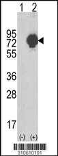 Western blot analysis of his-tag RIPK2 (arrow) using his tag antibody. 293 cell lysates (2 ug/lane) either nontransfected (Lane 1) or transiently transfected with the RIPK2 gene (Lane 2, Cat. #LY10610a).