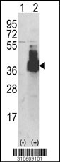 Western blot analysis of his-tag PDXK (arrow) using his tag antibody. 293 cell lysates (2 ug/lane) either nontransfected (Lane 1) or transiently transfected with the PDXK gene (Lane 2, Cat. #LY10609a).