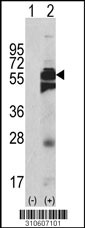 Western blot analysis of his-tag PTPN1 (arrow) using his tag antibody. 293 cell lysates (2 ug/lane) either nontransfected (Lane 1) or transiently transfected with the PTPN1 gene (Lane 2, Cat. #LY10607a).
