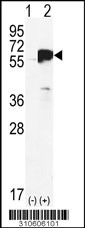 Western blot analysis of his-tag USP22 (arrow) using his tag antibody. 293 cell lysates (2 ug/lane) either nontransfected (Lane 1) or transiently transfected with the USP22 gene