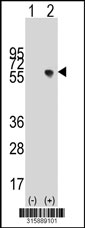 Western blot analysis of his-tag NKAPL (arrow) using his tag antibody. 293T cell lysates (2 ug/lane) either nontransfected (Lane 1) or transiently transfected with the NKAPL gene‘