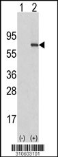 Western blot analysis of his-tag FBXL7 (arrow) using his tag antibody. 293 cell lysates (2 ug/lane) either nontransfected (Lane 1) or transiently transfected with the FBXL7 gene (Lane 2, Cat. #LY10603a).