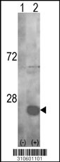 Western blot analysis of his-tag UBE2B (arrow) using his tag antibody. 293 cell lysates (2 ug/lane) either nontransfected (Lane 1) or transiently transfected with the UBE2B gene (Lane 2, Cat. #LY10601a).