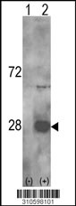 Western blot analysis of his-tag PSMB2 (arrow) using his tag antibody. 293 cell lysates (2 ug/lane) either nontransfected (Lane 1) or transiently transfected with the PSMB2 gene (Lane 2, Cat. #LY10598a).