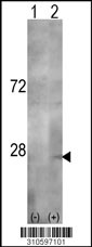Western blot analysis of his-tag IFNA5 (arrow) using his tag antibody. 293 cell lysates (2 ug/lane) either nontransfected (Lane 1) or transiently transfected with the IFNA5 gene (Lane 2, Cat. #LY10597a).