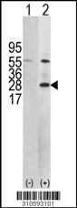 Western blot analysis of his-tag SPDYA (arrow) using his tag antibody. 293 cell lysates (2 ug/lane) either nontransfected (Lane 1) or transiently transfected with the SPDYA gene (Lane 2, Cat. #LY10593a).