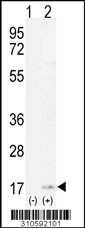 Western blot analysis of his-tag MDP1 (arrow) using his tag antibody. 293 cell lysates (2 ug/lane) either nontransfected (Lane 1) or transiently transfected with the MDP1 gene