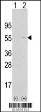 Western blot analysis of his-tag PPM2C (arrow) using his tag antibody. 293 cell lysates (2 ug/lane) either nontransfected (Lane 1) or transiently transfected with the PPM2C gene