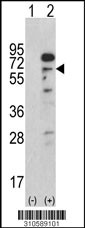 Western blot analysis of his-tag FOXO4 (arrow) using his tag antibody. 293 cell lysates (2 ug/lane) either nontransfected (Lane 1) or transiently transfected with the FOXO4 gene (Lane 2, Cat. #LY10589a).